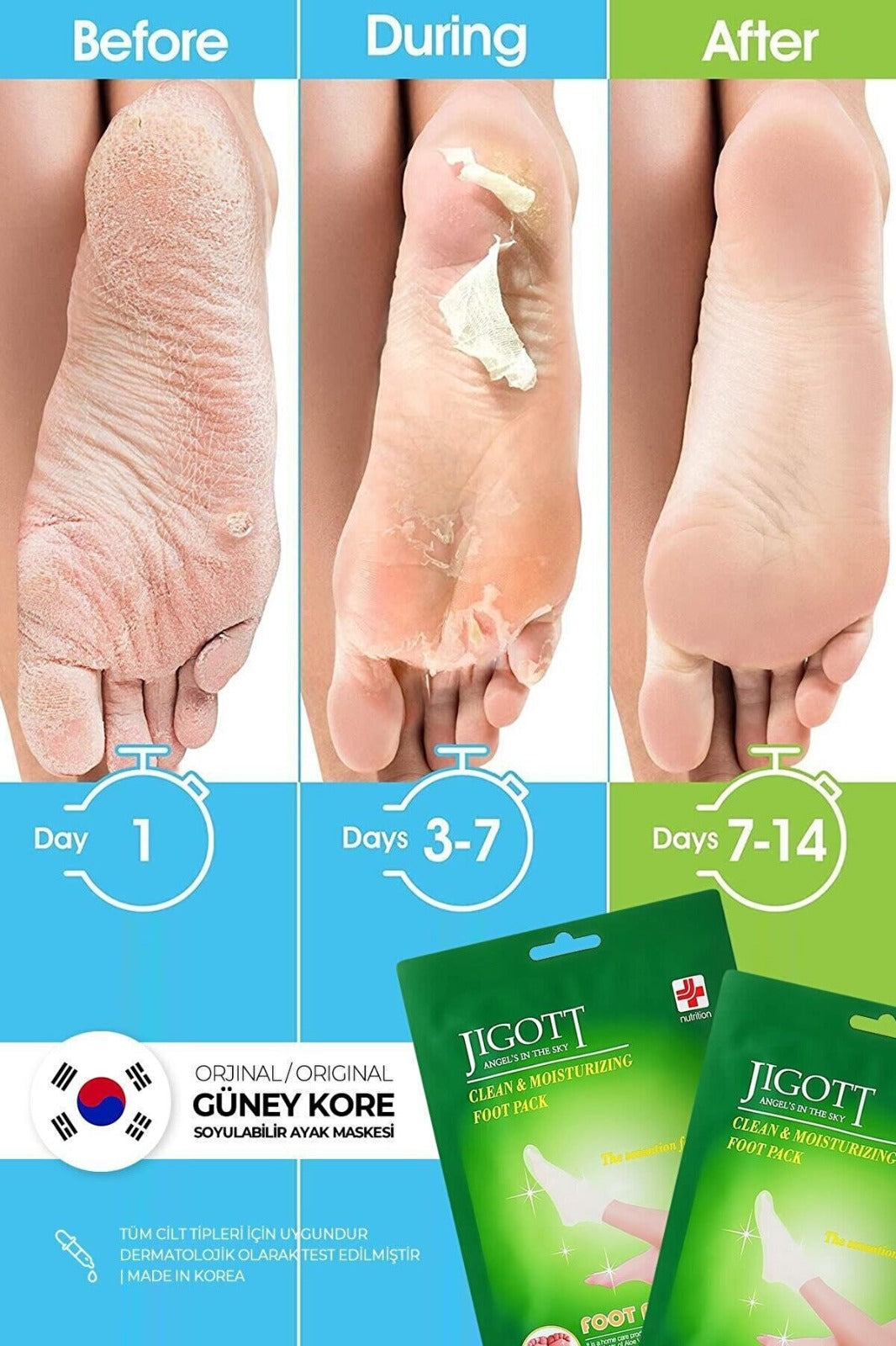 Jigott Sock Type Peeling Foot Peel Mask - Miracle Foot Peeling Pack